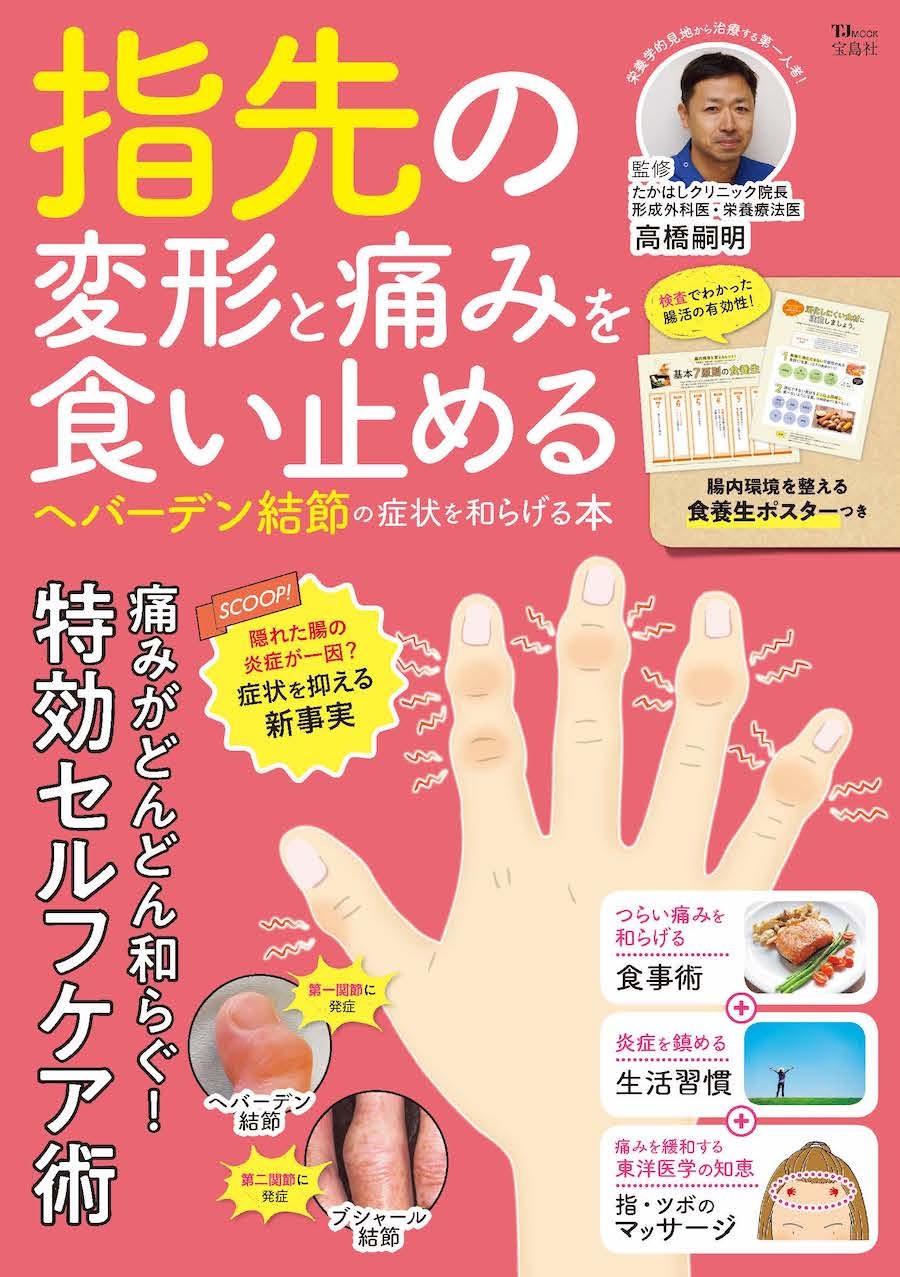 「指先の変形と痛みを食い止める」ヘバーデン結節の症状を和らげる本