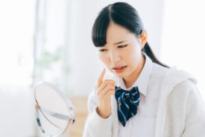 治らない思春期ニキビ・あごニキビの原因は？漢方と栄養アプローチ